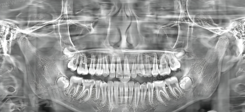 三、乌鲁木齐天牙口腔医院价格表yanke.yadoo.cn