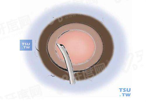 三、吉林恒达眼科医院收费标准yanke.yadoo.cn