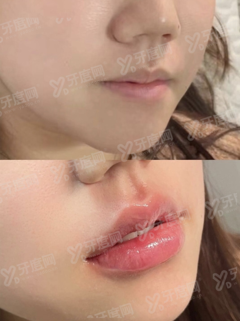 二、广西爱思特整形外科医院是三等甲吗yanke.yadoo.cn