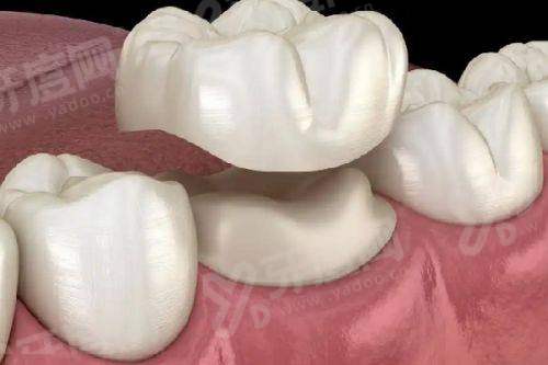 三、北京海鲸口腔价格表？（各项目收费透明合理）yanke.yadoo.cn