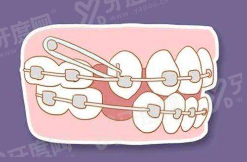 二、怀柔优贝口腔医院怎么样？（正规资质+技术精良+服务贴心）yanke.yadoo.cn
