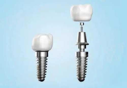 邵阳隆回城东雅贝康口腔医院上班时间：早8:00-晚20:00无休！地址在隆回县桃花坪街道