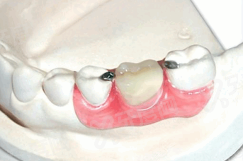 二、长沙雅贝康口腔门诊部（望城店）价格明细公开透明yanke.yadoo.cn