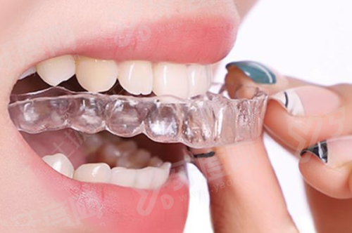 三、邵阳隆回城东雅贝康口腔医院价格表？（公开透明，性价比高，项目齐全）yanke.yadoo.cn