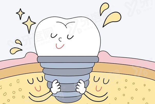 无锡佳士洁口腔门诊做全口种植牙多少钱？6 万起配瑞士植体，技术稳恢复快更安心