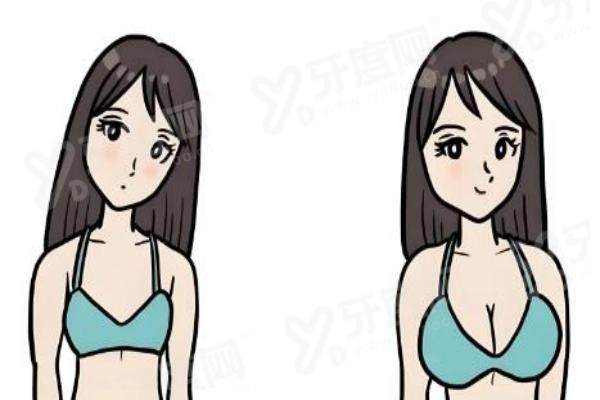 苏州陈柳艺做胸怎么样？薇琳内窥镜双平面技术自然灵动恢复快口碑好