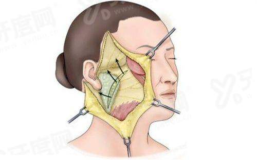 一、郑州东方整形美容医院医生介绍？（医生团队实力雄厚，经验多）yanke.yadoo.cn