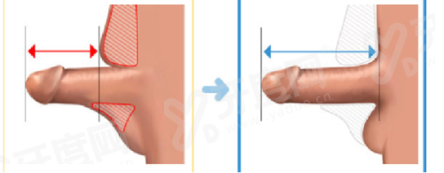 郑州东方整形美容医院收费贵吗；技术精湛价格透明让美丽更安心
