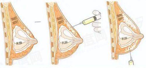 二、郑州东方整形美容医院怎么样？真实实例告诉你答案！yanke.yadoo.cn