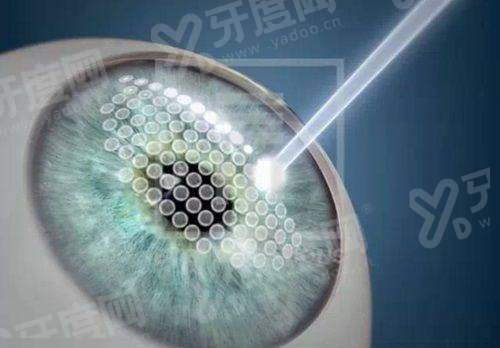 二、常德市第一人民医院眼科医生技术靠谱吗？yanke.yadoo.cn