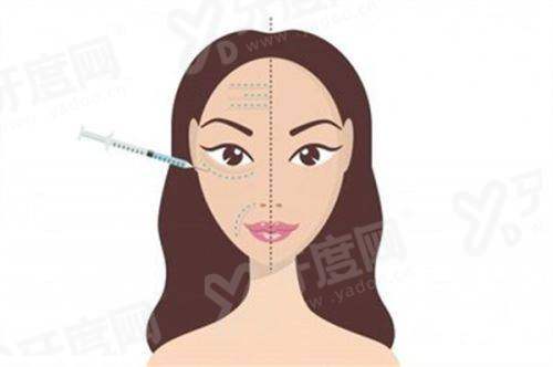 上海艺星孙玮奇做双眼皮怎么样？微创技术+自然无痕+恢复快+效果持久