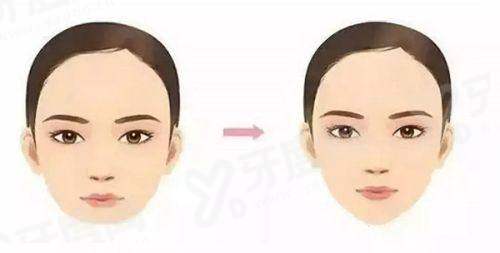 二、以色列雅定种植牙 2500 元一颗yanke.yadoo.cn