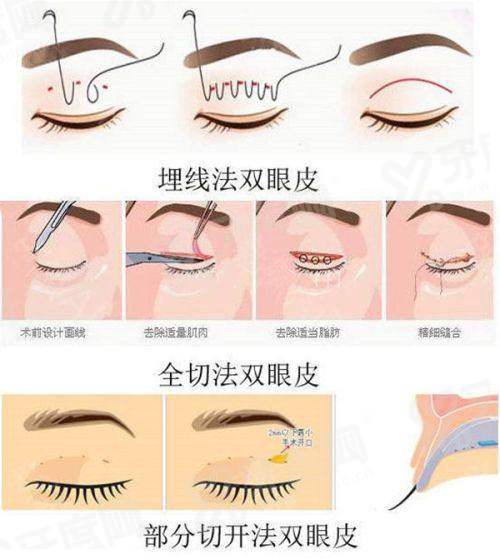 一、北京雍禾植发医院(北京总院)收费标准？价格透明合理，性价比高yanke.yadoo.cn