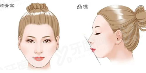 二、郑州东方整形美容医院口碑如何?真实实例见证美丽蜕变yanke.yadoo.cn