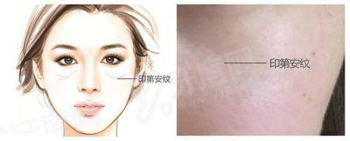 二、如何预约徐荣阳医生？在线预约与电话预约指南yanke.yadoo.cn