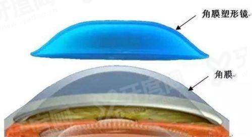 一、凌源爱尔眼科医院营业时间yanke.yadoo.cn