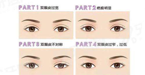 二、如何预约郑州东方整形美容医院朱怡梦医生的双眼皮手术？yanke.yadoo.cn