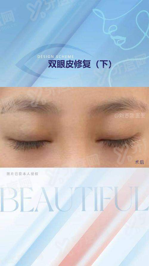 二、如何选择适合自己的眼修复医生？yanke.yadoo.cn