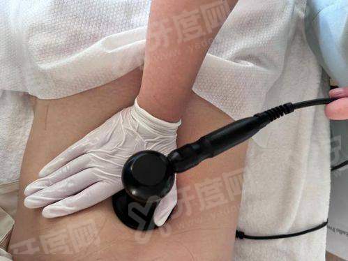 二、如何预约郑州东方整形美容医院朱怡梦医生的吸脂塑形手术？yanke.yadoo.cn