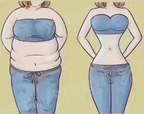 郑州东方整形美容医院朱怡梦吸脂塑形手术成功率高吗？专业团队精准操作术后效果自然满意率高