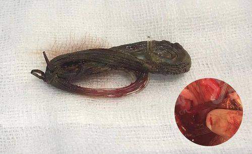 二、如何预约郑州东方整形美容医院朱怡梦医生的异物取出手术？yanke.yadoo.cn