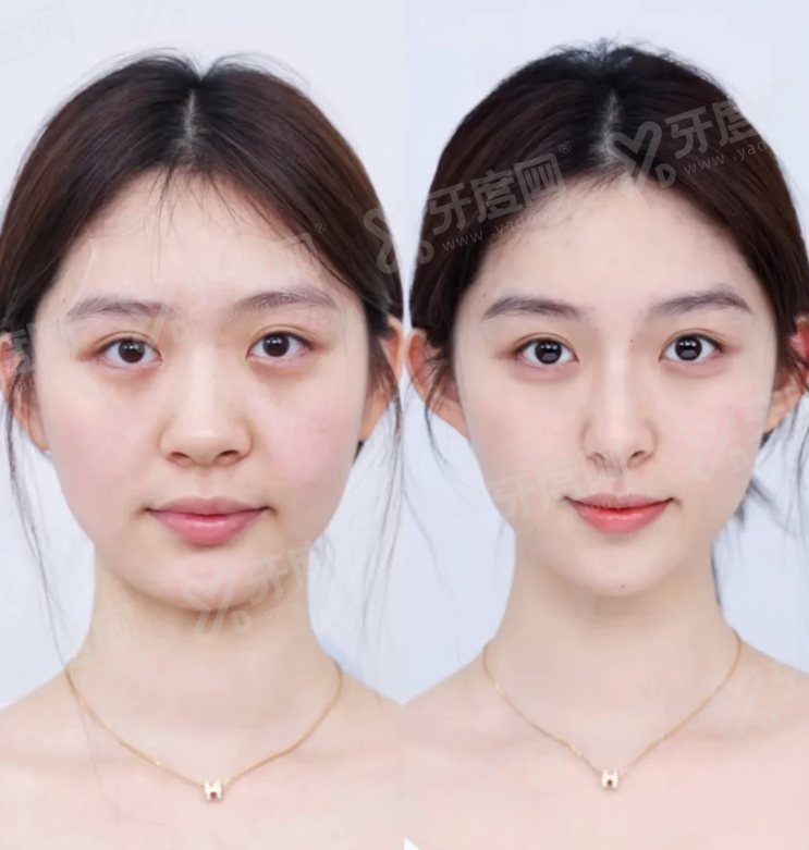 二、郑州东方整形美容医院朱怡梦医生坐诊信息及预约方式yanke.yadoo.cn