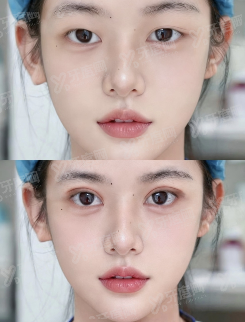 一、西安亚美医疗美容医院好不好?综合实力突出值得信赖yanke.yadoo.cn