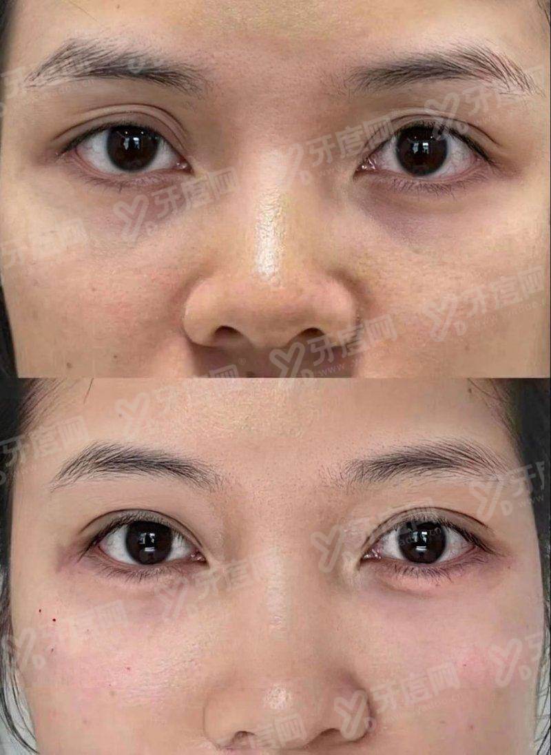 二、西安亚美医疗美容医院口碑怎么样?真实实例见证品质实力yanke.yadoo.cn