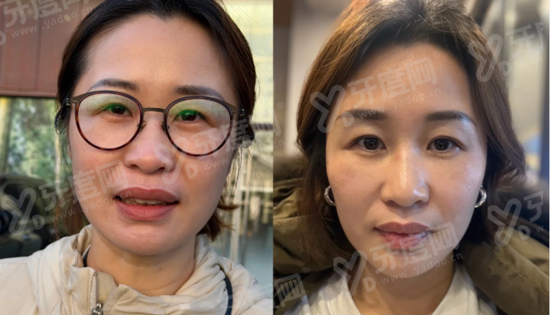 二、郑州东方整形美容医院朱怡梦医生的口碑如何？yanke.yadoo.cn