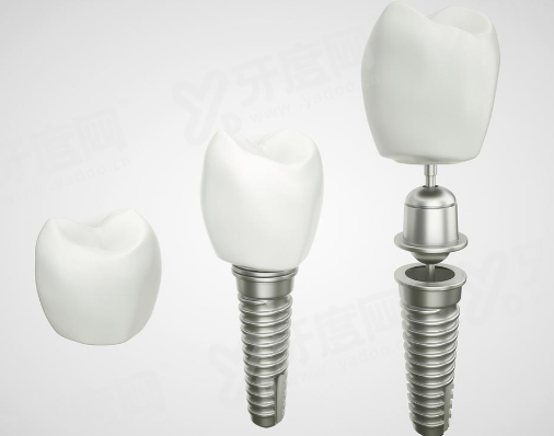 三、深圳友睦口腔陈钢医生怎么预约挂号？yanke.yadoo.cn