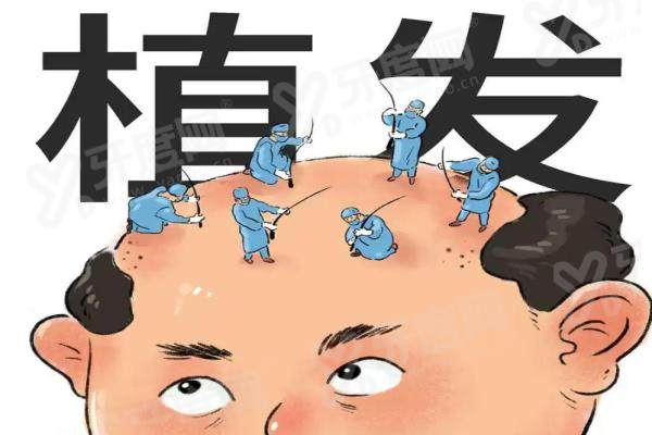 北京碧莲盛和北京雍禾植发哪家好？碧莲盛主打不剃发技术，雍禾植发擅长大面积种植