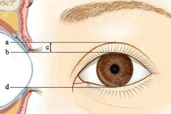 杜园园眼修复患者真实评价咋样？层次复位闭眼无痕，附预约攻略与价格表