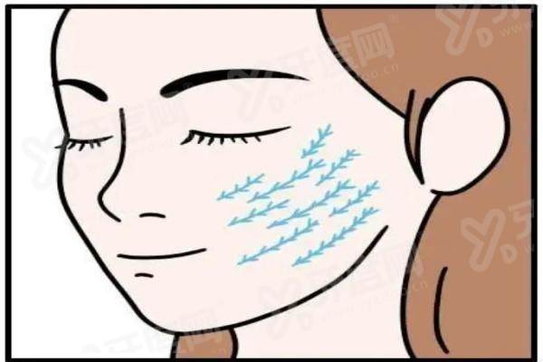 高亚东做拉皮效果好吗？微创提升自然年轻，附价格明细与预约方式