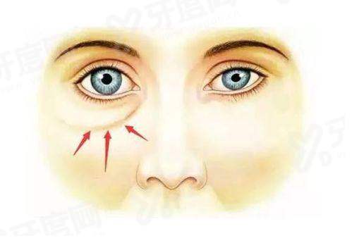 二、张朝梅医生怎么预约挂号?yanke.yadoo.cn