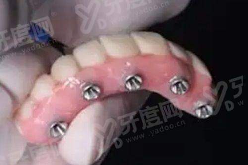 二、深圳友睦口腔医院地址yanke.yadoo.cn