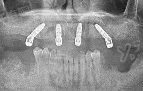 沈阳圣泰口腔医院上班时间：8:30-17:30周末无休！地址在和平区太原南街116号