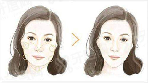 三、如何预约田浩医生及就诊指南yanke.yadoo.cn