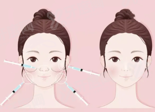 一、李高峰隆胸好还是陈星光隆胸好？yanke.yadoo.cn