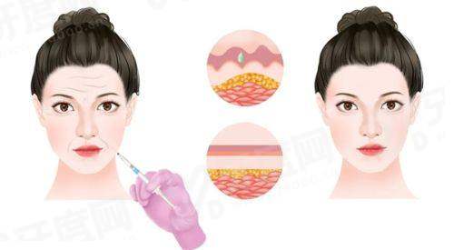 杭州星纪医疗美容门诊部正规吗？技术精湛，打造自然灵动美，专业服务值得信赖