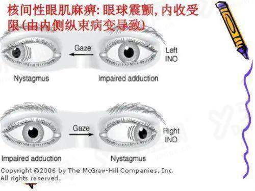 一、广州普瑞眼科医院做近视眼手术怎么样yanke.yadoo.cn