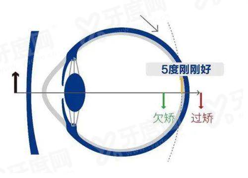 三、在日照博恩眼科医院看病怎么预约？价格贵吗？yanke.yadoo.cn