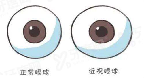 一、沧州爱尔眼科怎么预约挂号？yanke.yadoo.cn