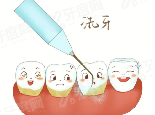 三、介绍长沙中诺口腔医院怎么样？（正规可靠且服务优质）yanke.yadoo.cn