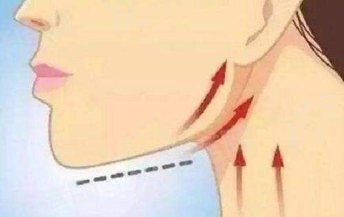 深圳罗文丽格医疗美容吸脂怎么样？精准塑形效果自然恢复快技术先进；