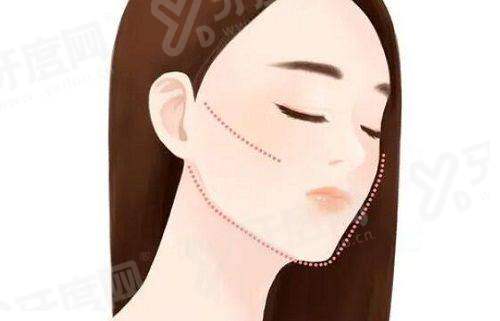 深圳美莱整形医院的脂肪专家医生有谁？技术精湛塑造完美曲线，脂肪管理更安心；