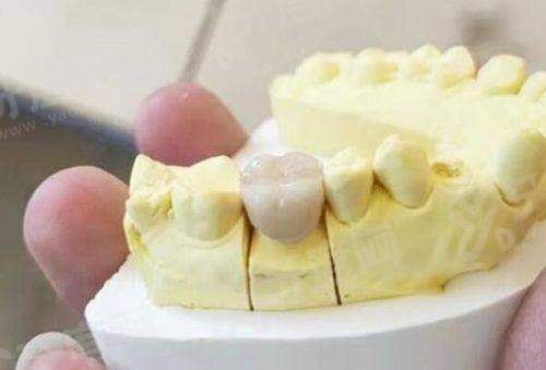 三、金华蓝芽口腔医院地址在哪里？在婺城区中山路269号yanke.yadoo.cn