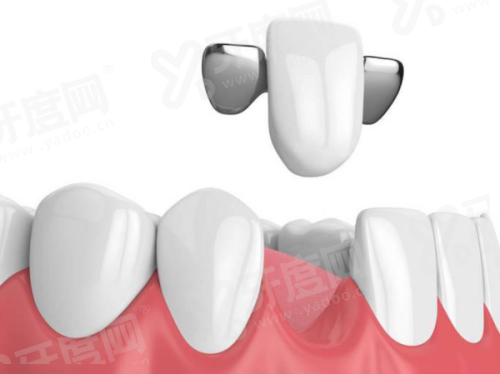 三、介绍北京大兴兴业口腔医院价格表?(价格实惠,项目丰富)yanke.yadoo.cn