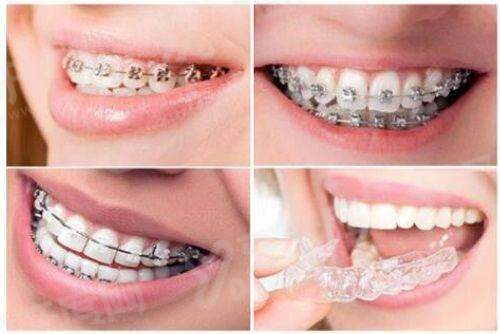 上海圣康口腔医院预约挂号攻略：3种挂号方式，附种植/矫正价格表+地址路线