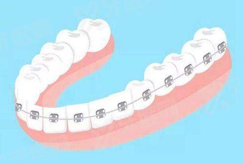 乌鲁木齐双宝口腔医院正规吗？资质齐全技术强，价格透明无隐形消费，正规靠谱口碑赞
