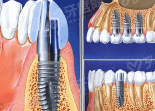 三、九江中山口腔医院牙齿矫正多少钱地址在哪？yanke.yadoo.cn